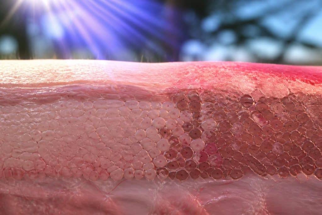 découvrez comment le coup de soleil provoque la destruction des cellules épidermiques grâce à notre guide complet sur les rayons uv et leurs effets sur la peau.