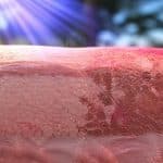 découvrez comment le coup de soleil provoque la destruction des cellules épidermiques grâce à notre guide complet sur les rayons uv et leurs effets sur la peau.