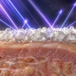 découvrez comment les filtres minéraux, comme l’oxyde de zinc et le dioxyde de titane, contribuent à protéger la peau des rayons uv.